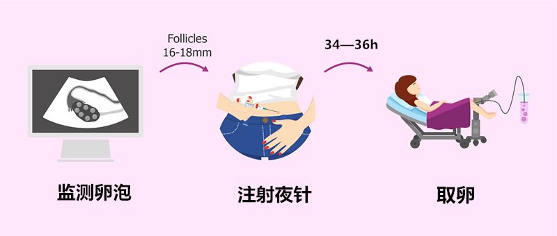 取卵后腹水移植流程及注意事项