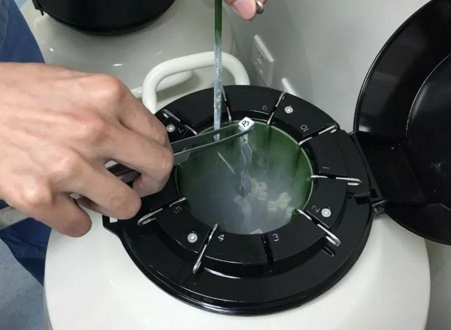 取卵后卵巢过激风险解析