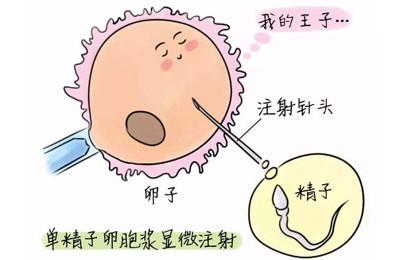 微刺激取卵技术，一般需进行几次取卵操作？